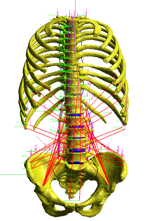 Integrated workflow of Finite Element and Multi Body modelling