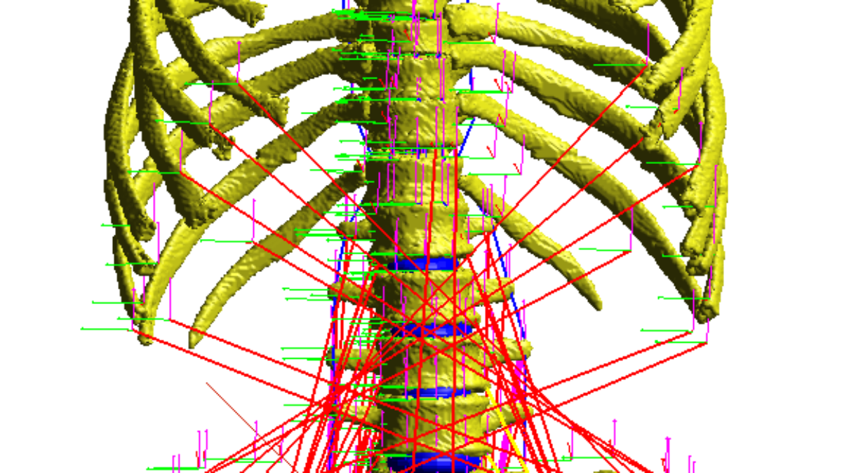 Integrated workflow of Finite Element and Multi Body modelling